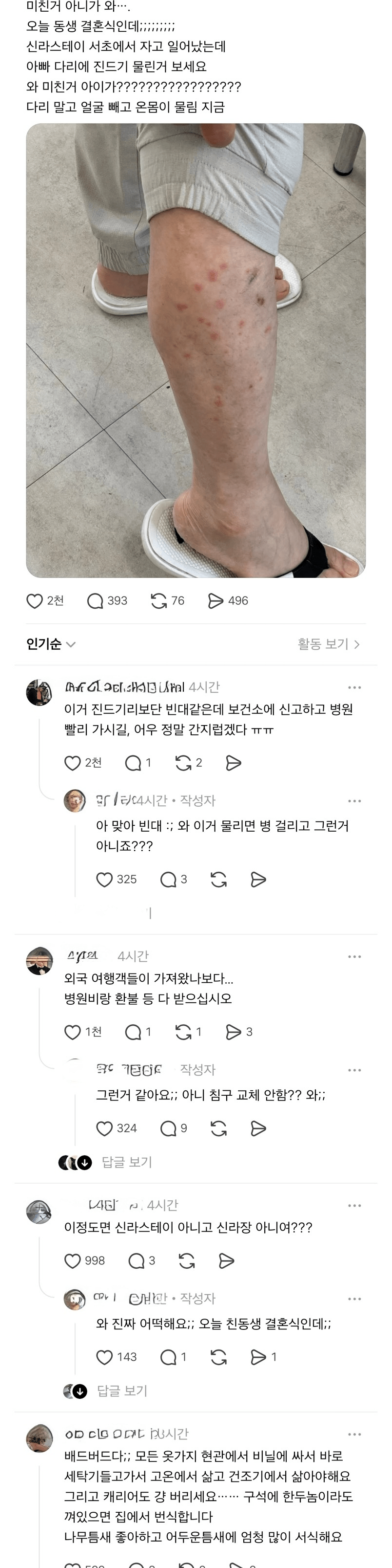신라스테이 호텔에서 자고 일어났는데 아빠 다리가...;;;
