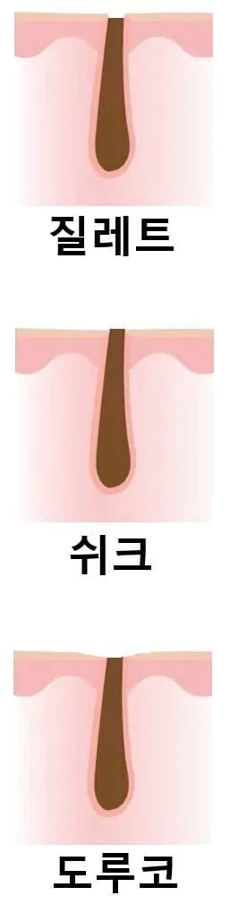 면도날 3황의 면도후 느낌