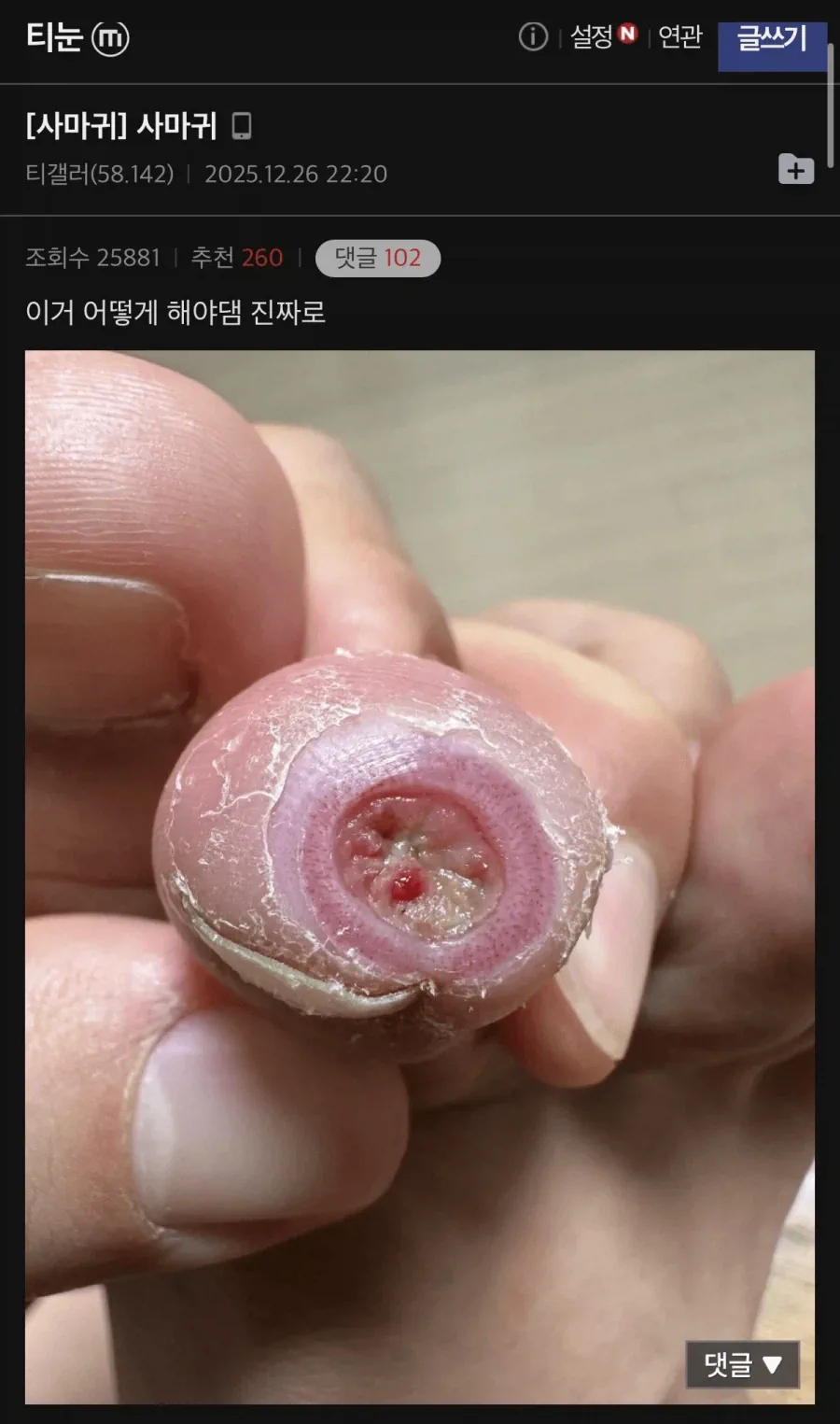 극혐 티눈갤 칠성장어 친구 근황