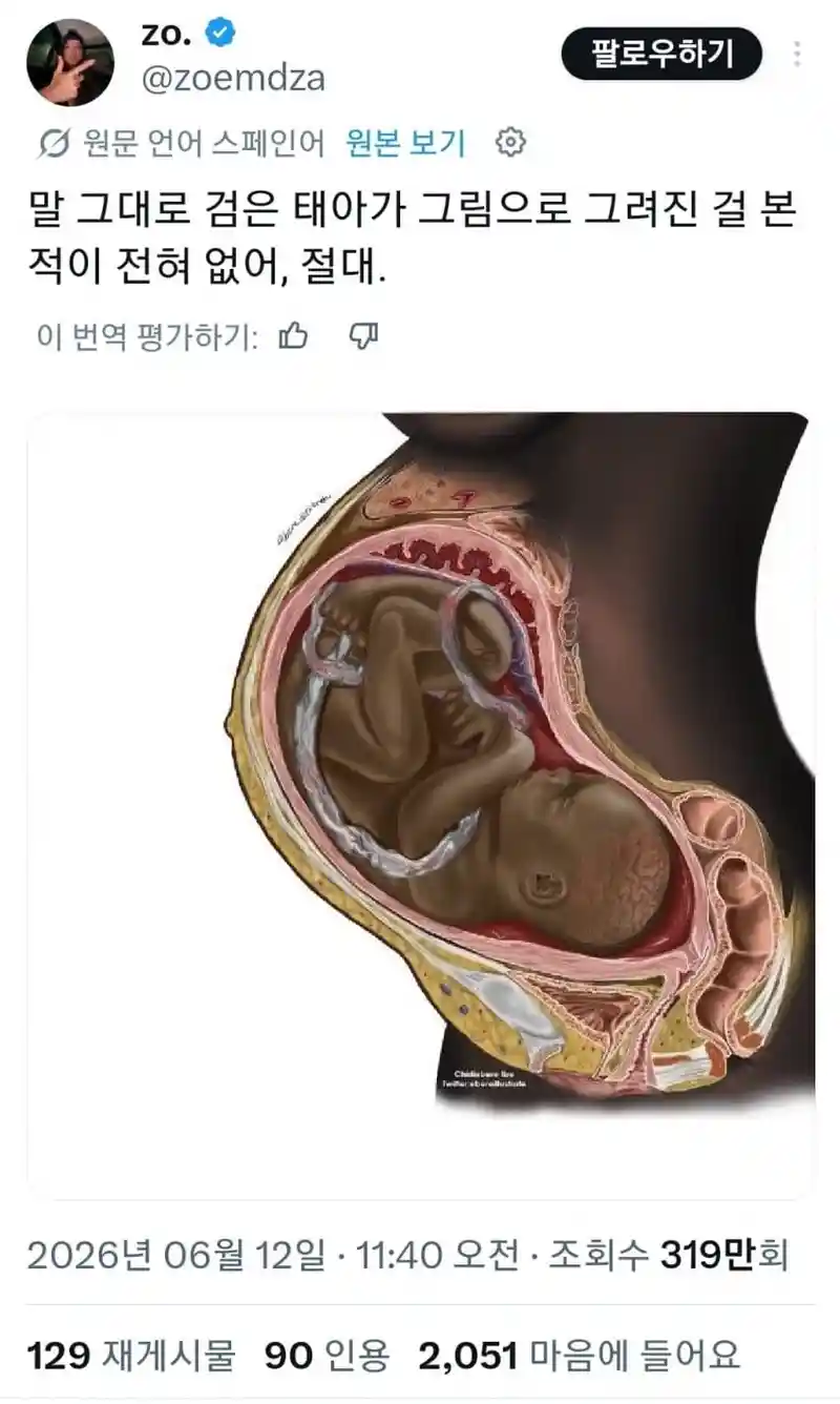 난 검은 태아를 본 적이 없어!!