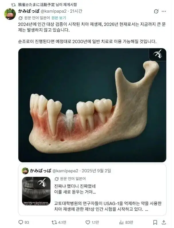 전 세계를 충격에 빠트린 일본 치아재생 기술 근황.jpg