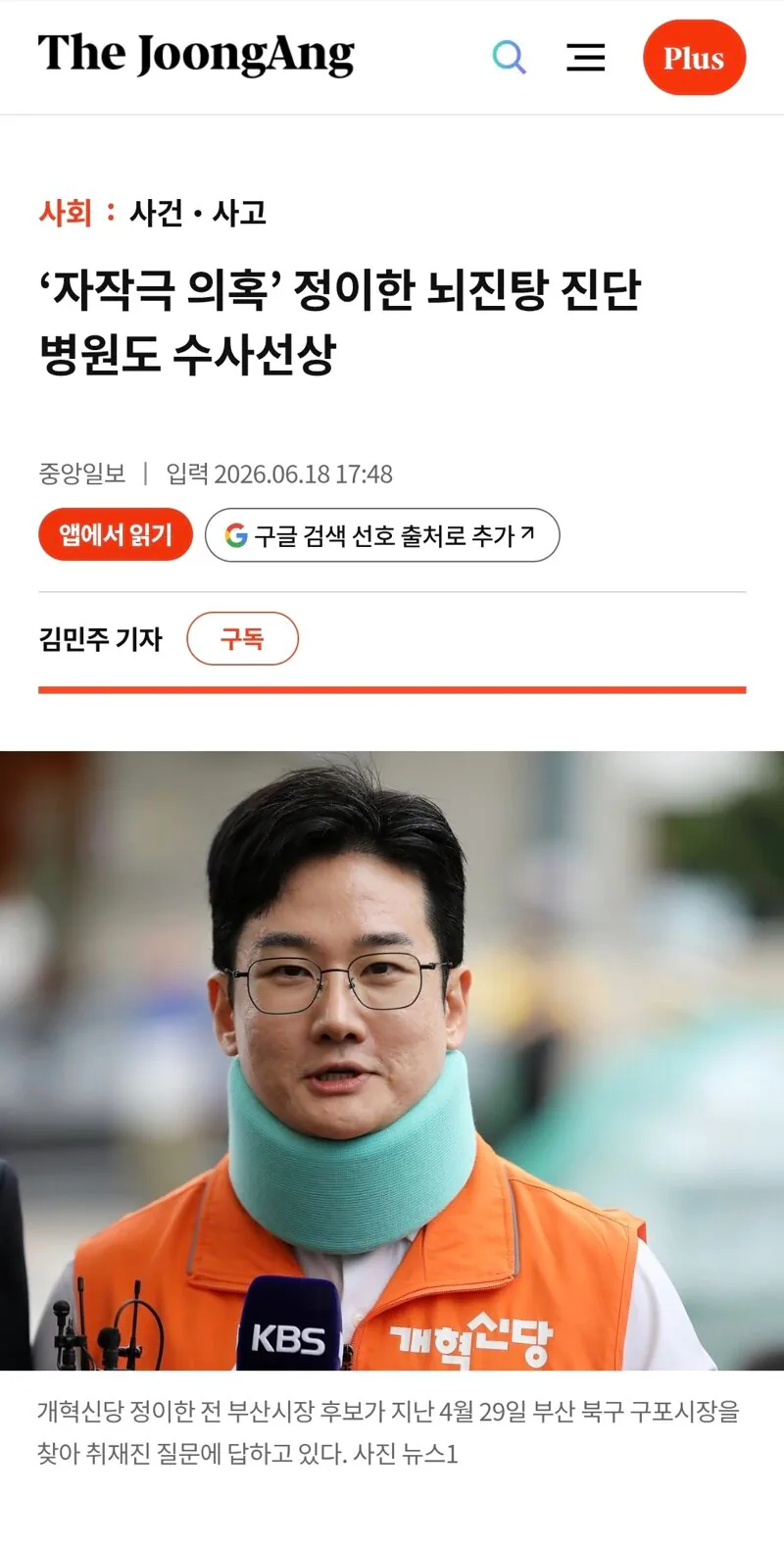 자작극 정이한 뇌진탕 진단 병원도 수사대상