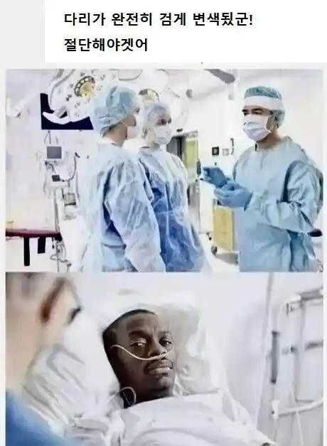 의사 : 이런 젠장.. 다리가 괴사해서 검게 변색됬어 절단해야겠어 !!