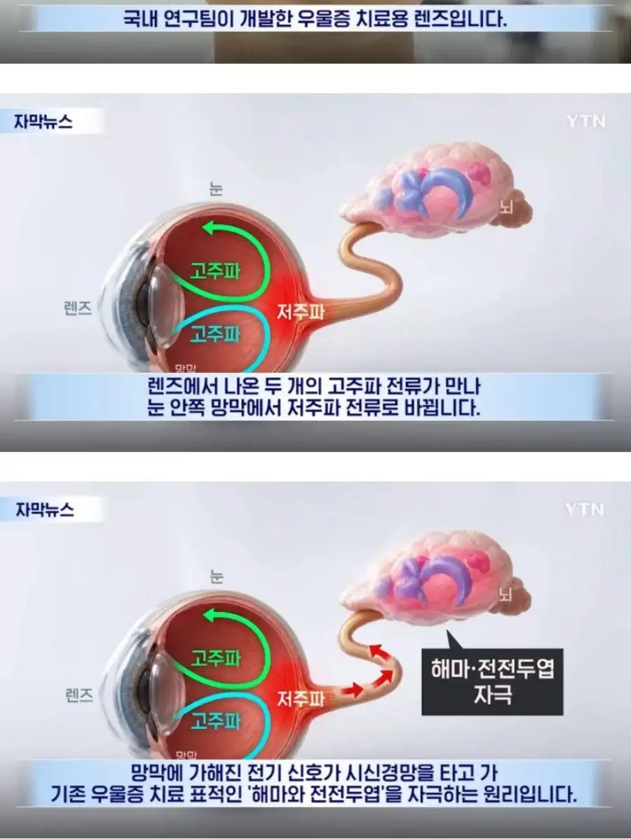 상상도 못한 국내 우울증 치료제 개발 근황 ㄷㄷ.jpg