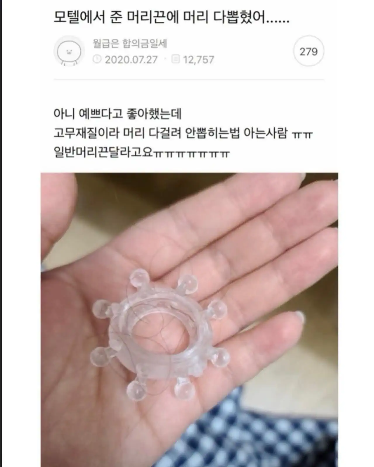 모텔에서 준 머리끈에 머리 다 뽑혔어
