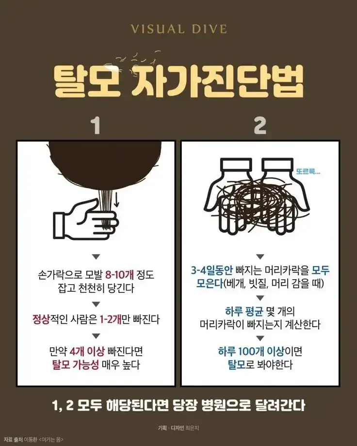 탈모 자가 진단법.jpg