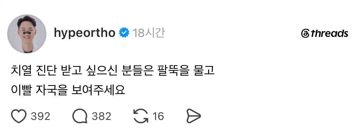 치열 진단 받고 싶으신 분들은 팔뚝을 물고 이빨 자국을 보여주세요