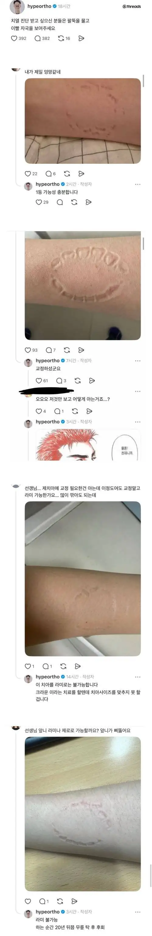 비대면으로 치열진단받기.jpg