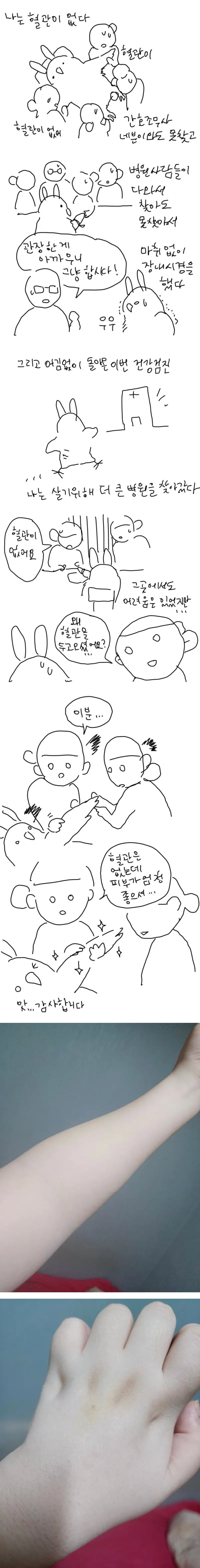 왜 혈관을 두고 오셨어요?