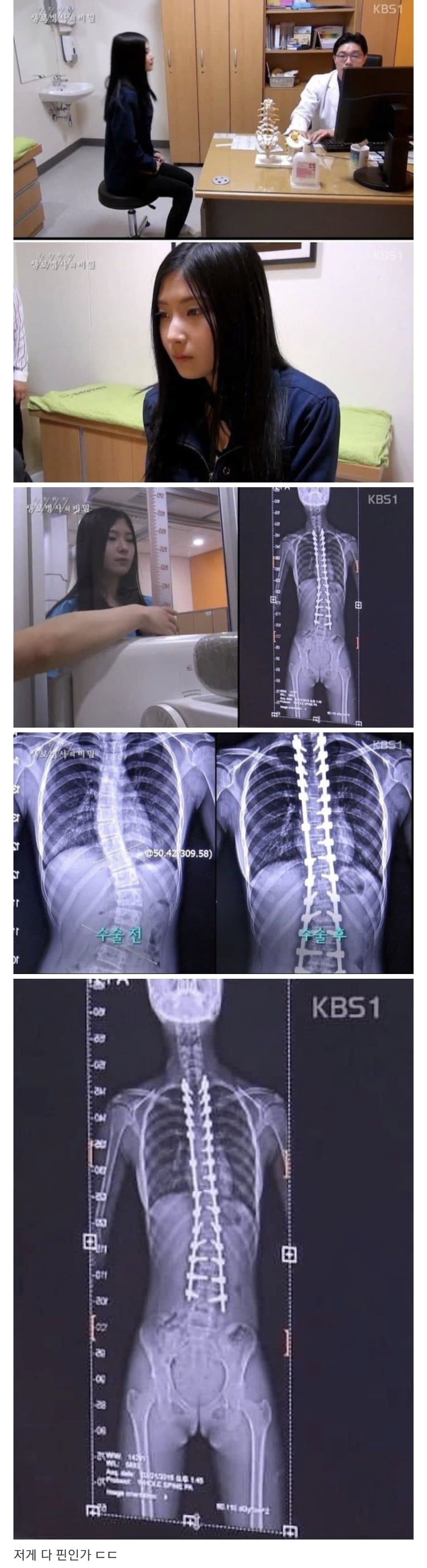 당신이 지금 허리를 펴야 하는 이유
