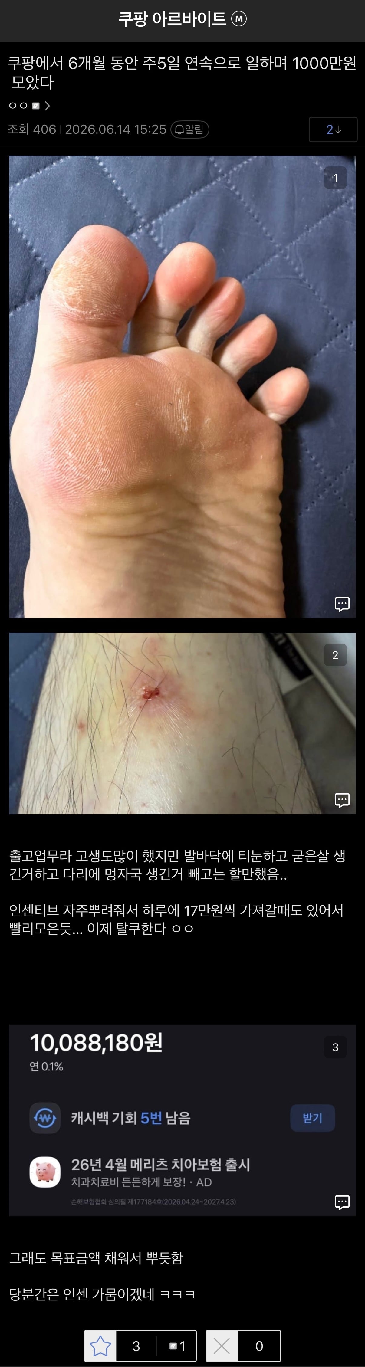 쿠팡에서 6개월 풀타임 일하고 1000만원 모은 알바갤러 ㄷㄷ