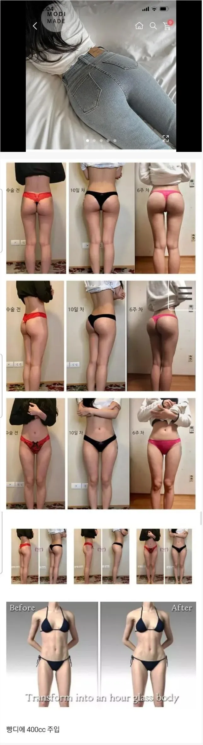 ㅇㅎ) 요즘 여자들이 꽤 많이한다는 수술