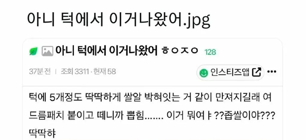 아니 턱에서 이거 나왔어.jpg