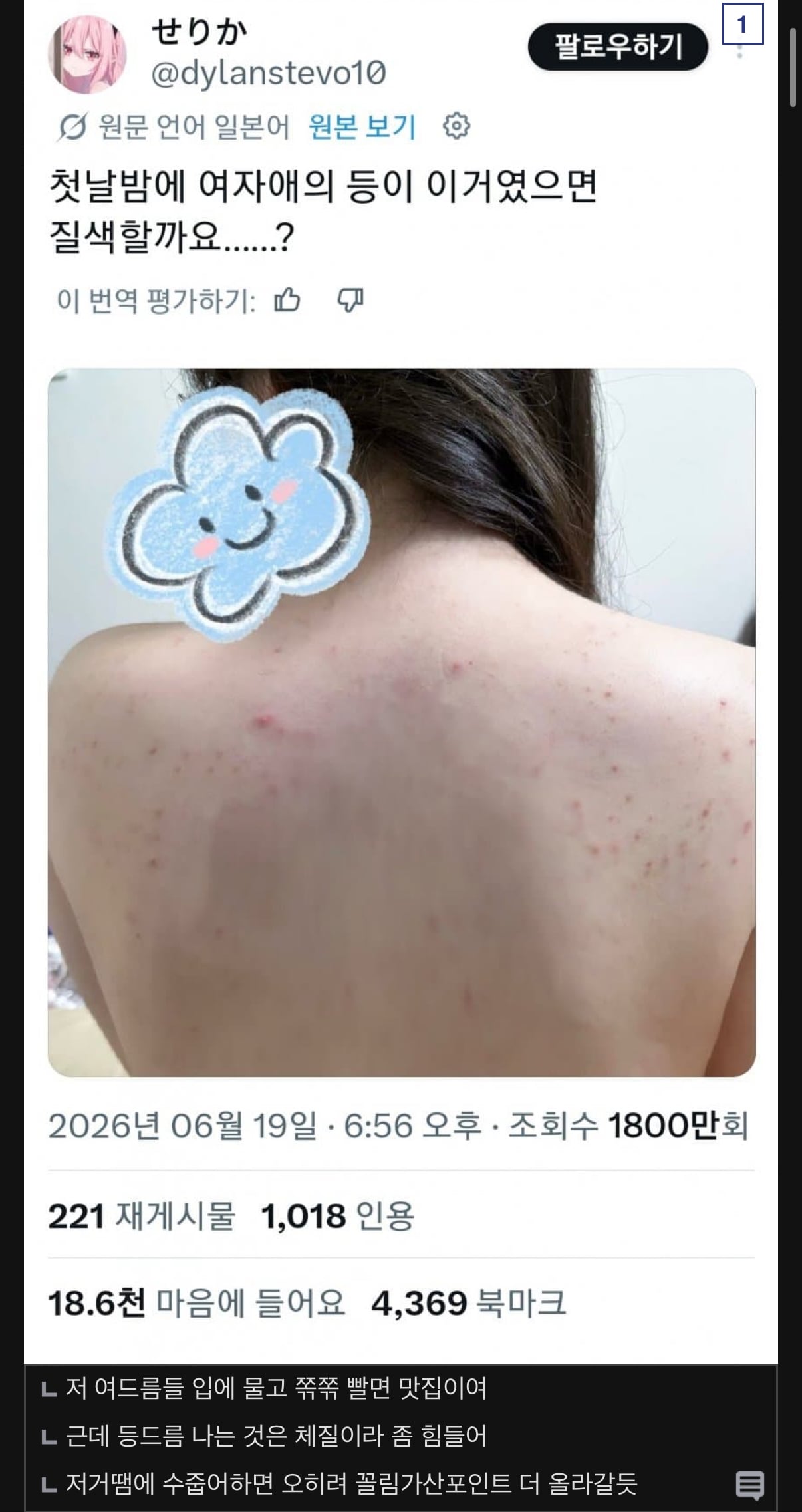 약혐) "첫날밤에 여자 등이 이러면 싫어할까요ㅠㅠ" .jpg