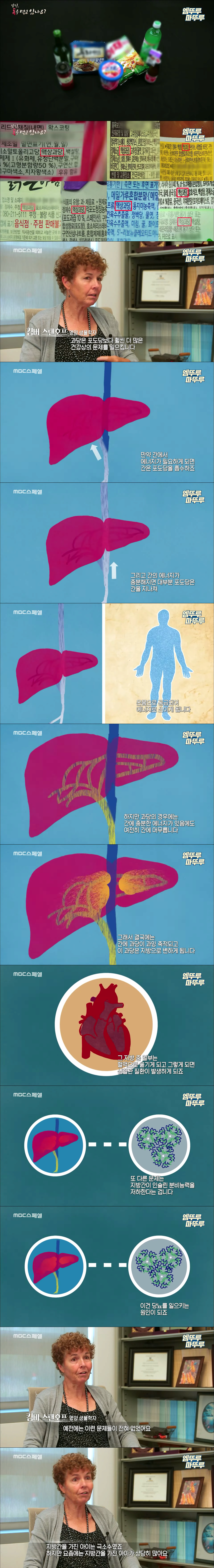 간수치가 높은 사람들 특징.jpg