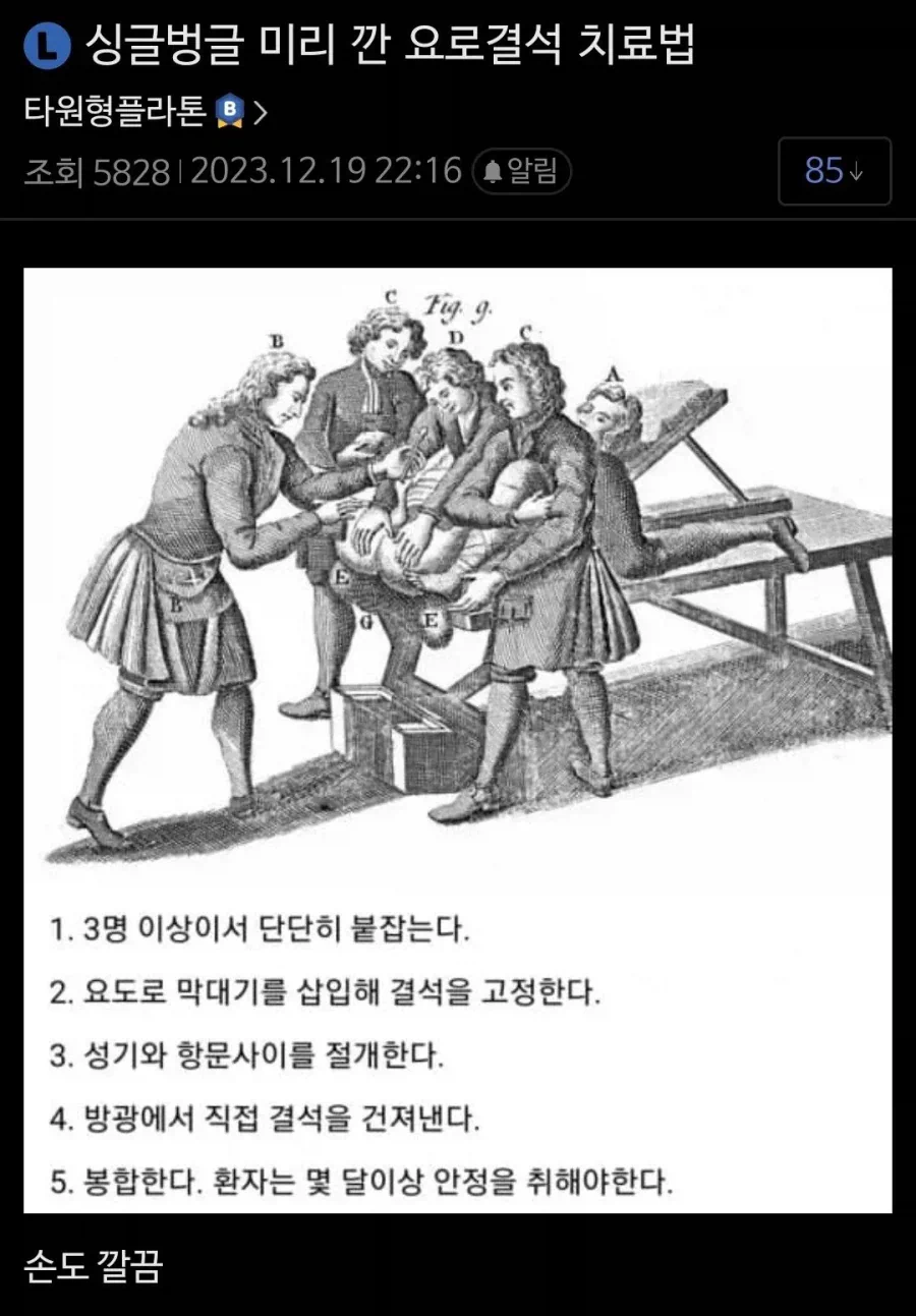 과거의 요로결석 치료법.jpg