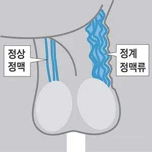 ㅎㅎㅎㅎ 아 놔 언박싱 ㅎㅎ 시민옹은 다 알고계셨구나 ㅎㅎㅎ
