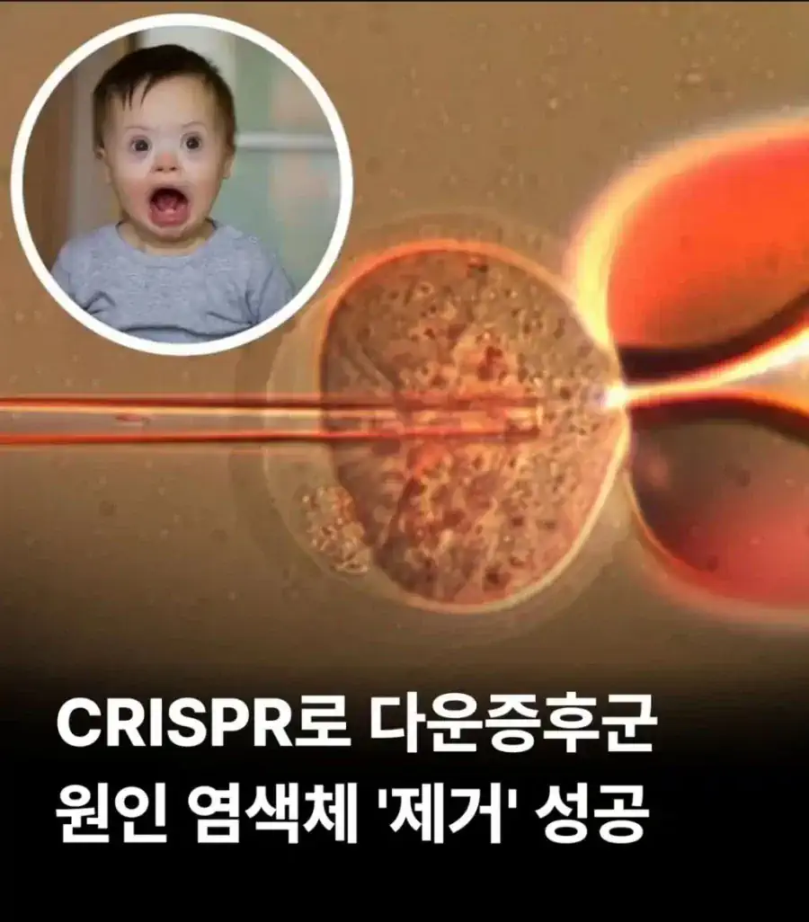 다운증후군 21번 염색체 제거 성공