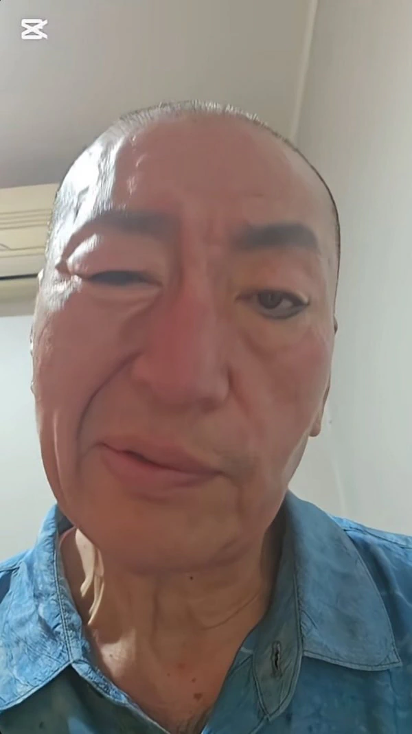 건강 악화된 유퉁 근황...jpg