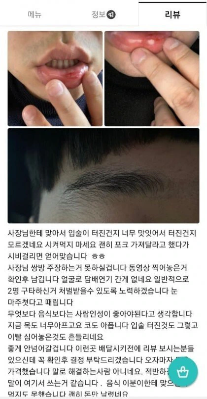 배달음식 시켰다가 사장한테 무자비하게 폭행당한 22살