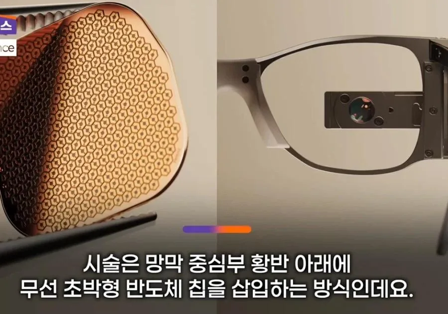 눈에 칩을 넣어서 시력을 회복해주는 기술