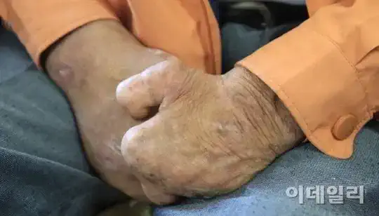 한센병 치료봉사를 종교인들이 하던 이유