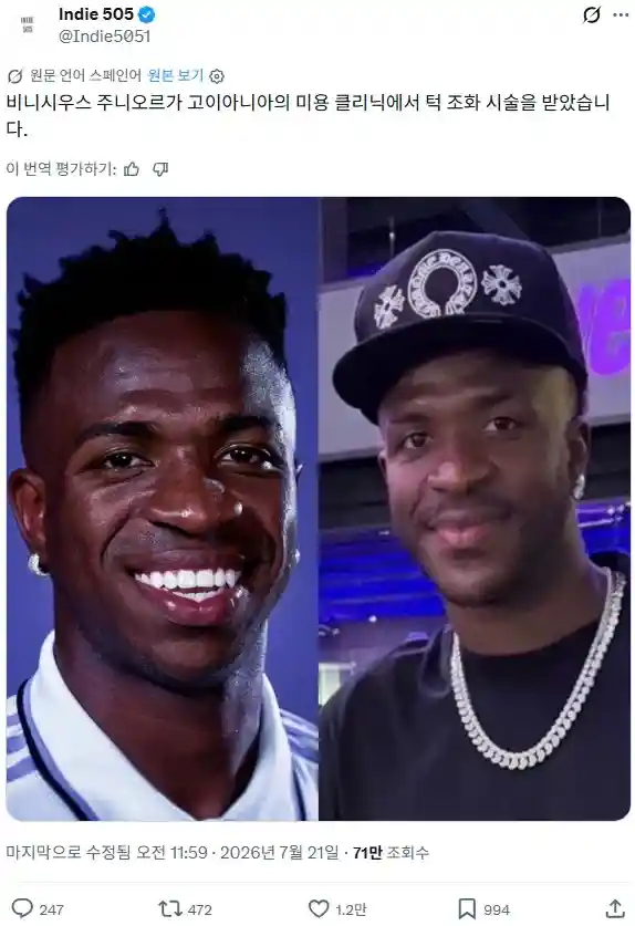 비니시우스 턱 성형
