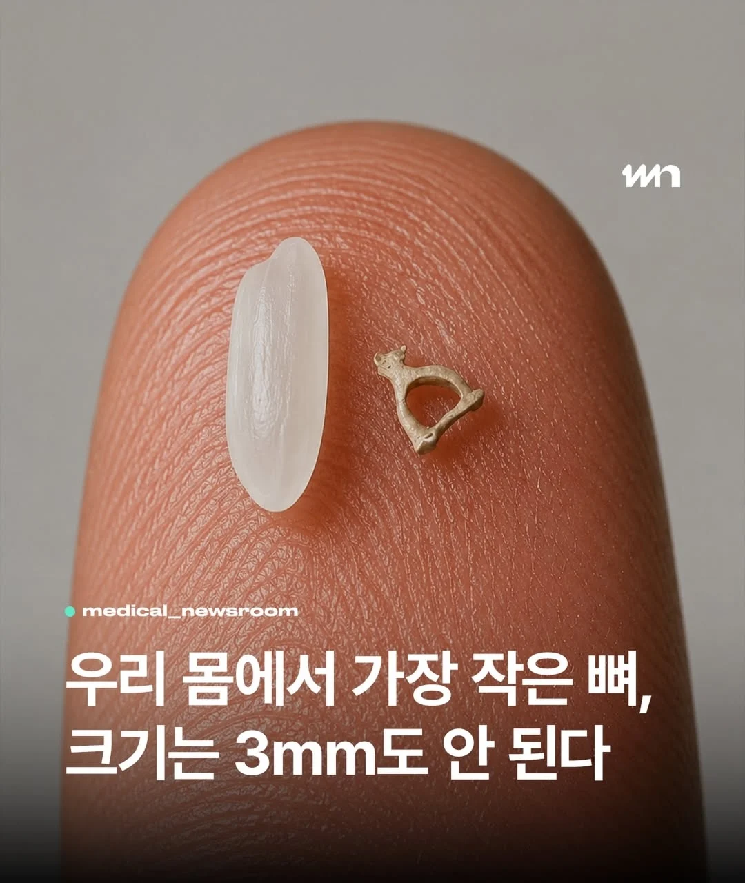 우리 몸에서 가장 작은 뼈