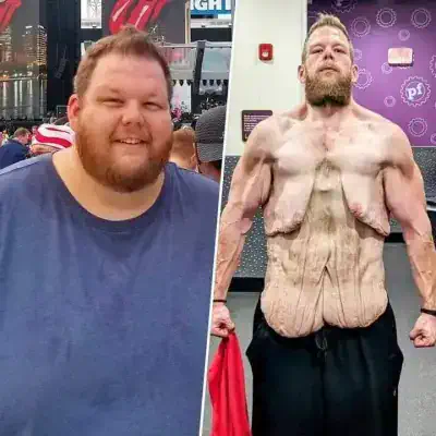약혐) 163kg 빼고 팬들에게 후원 부탁하는 스트리머
