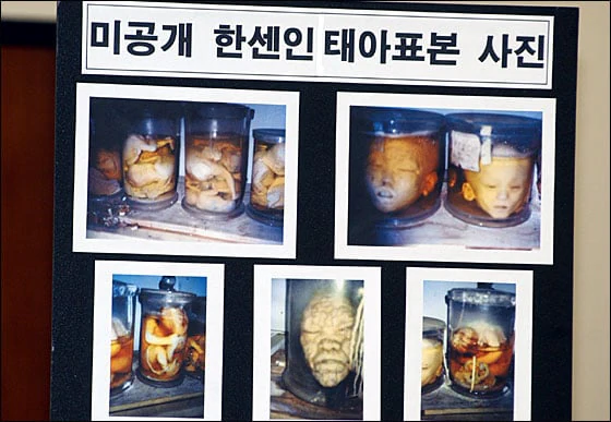 하영 "우리 할부지는 소록도 의사였다"