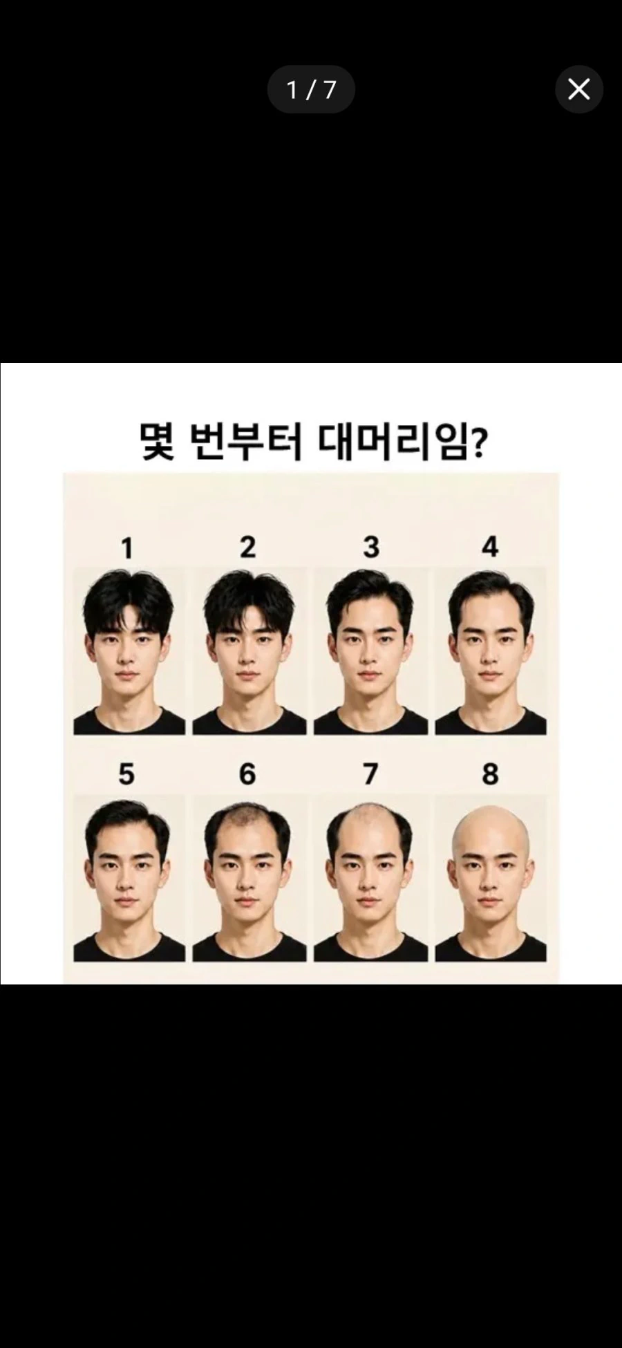 몇번부터 대머리 취급하나요