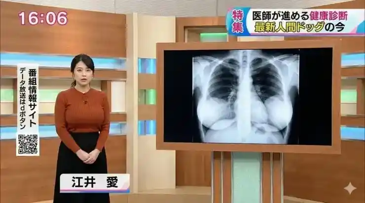 ㅇㅎ)일본 여자 아나운서 흉부 엑스레이