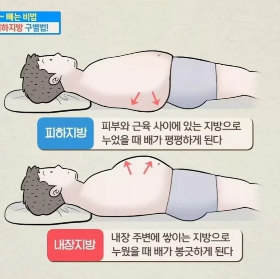 피하지방과 내장지방 구분법