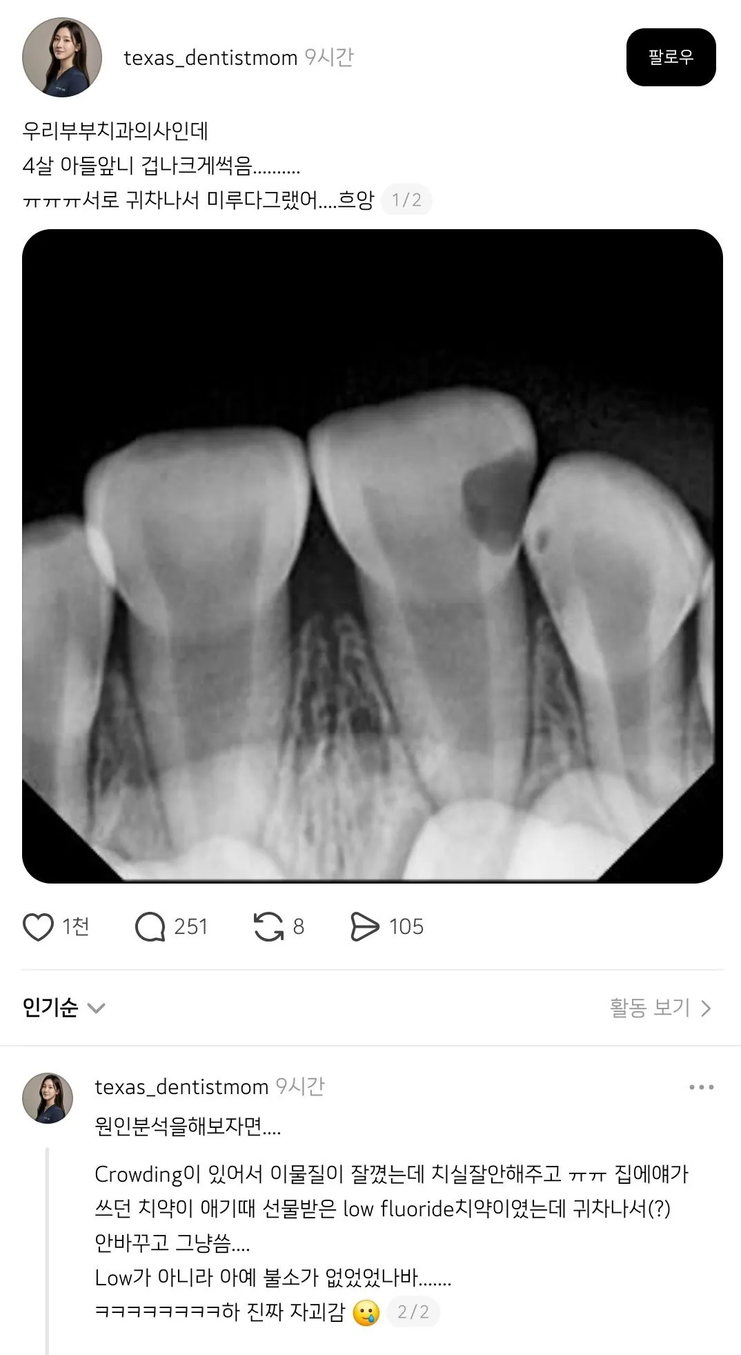 치과의사 부부 아이의 치아 상태