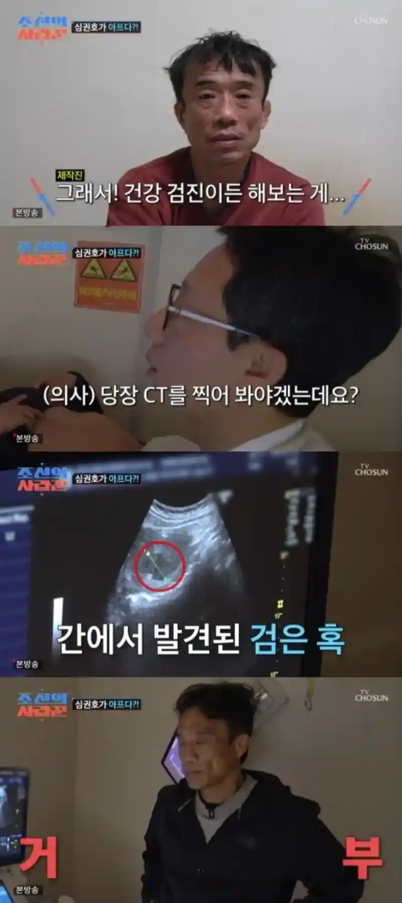 심권호 간암이였다...알려지는것도 싫고 두려웠다