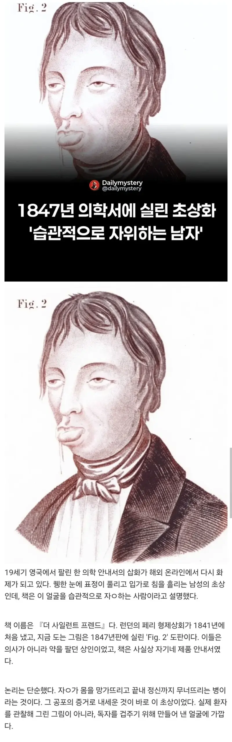 1847년 의학서에 실린 자위 많이하는 남자 초상화